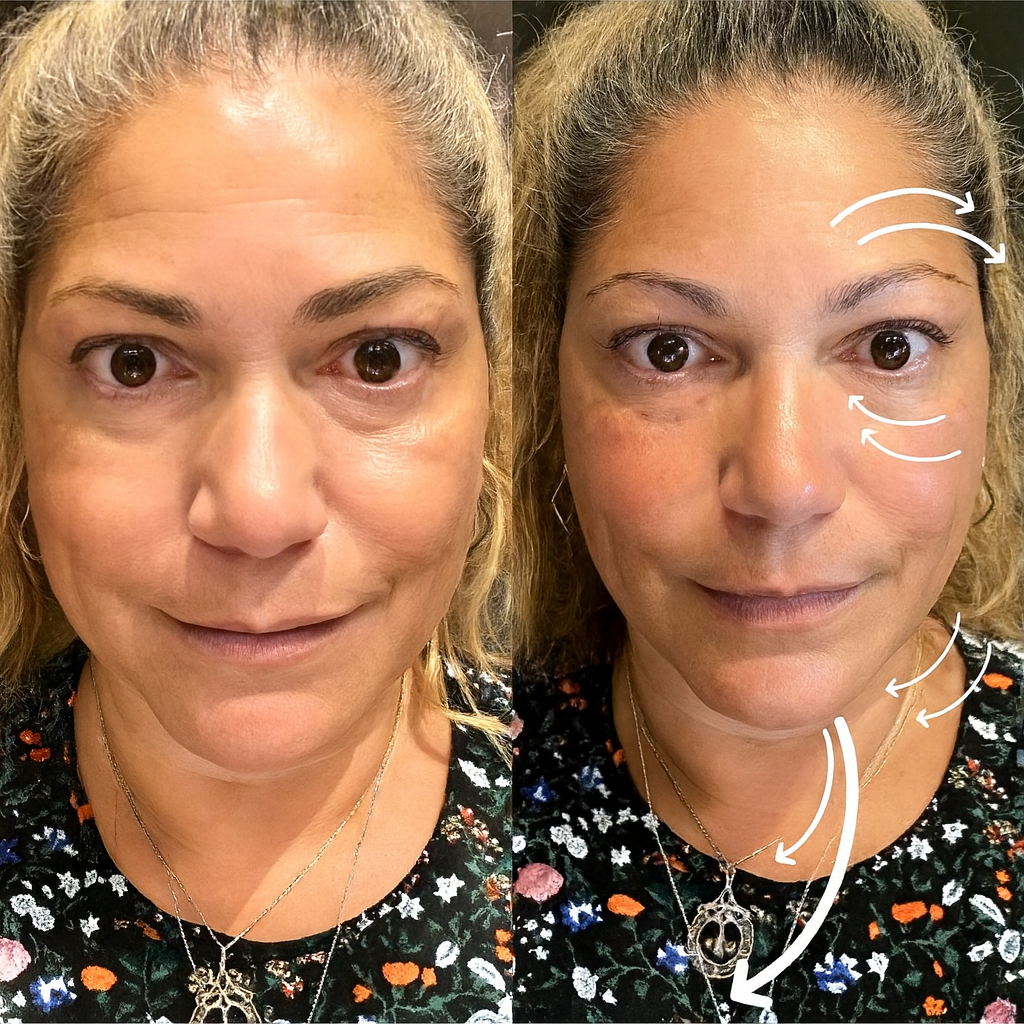 Lymphatic Contour Dry Face Brush