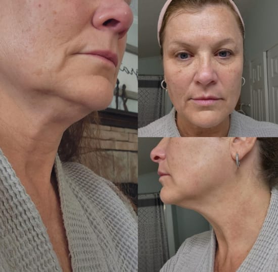Lymphatic Contour Dry Face Brush